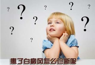 儿童白癜风怎么治疗呢