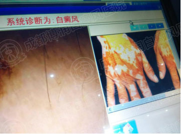 皮肤镜下检测.jpg